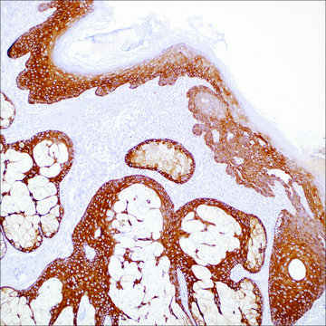 Cytokeratin 5 (EP1601Y) Rabbit Monoclonal Primary Antibody