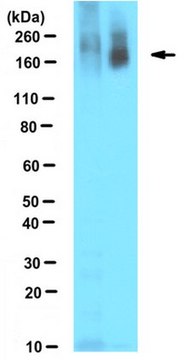 Anti-Poly ADP-ribose Antibody, clone 10H clone 10H, from mouse