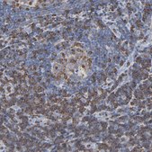 Anti-SH3KBP1 antibody produced in rabbit Ab1, Prestige Antibodies® Powered by Atlas Antibodies, affinity isolated antibody, buffered aqueous glycerol solution