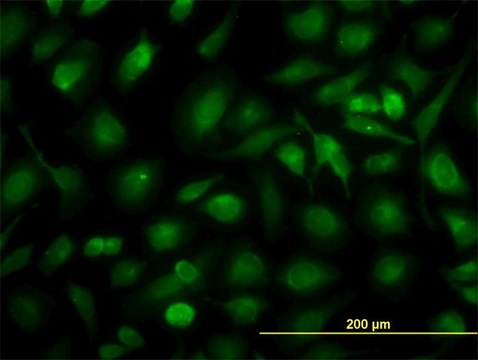 Monoclonal Anti-RLBP1 antibody produced in mouse clone 4H5, purified immunoglobulin, buffered aqueous solution