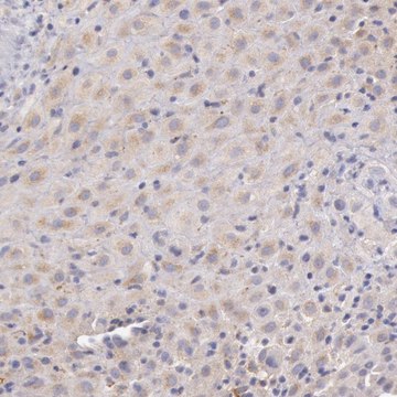 Anti-C1R antibody produced in rabbit Prestige Antibodies&#174; Powered by Atlas Antibodies, affinity isolated antibody