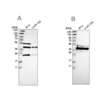 Anti-CCDC51 antibody produced in rabbit Prestige Antibodies&#174; Powered by Atlas Antibodies, affinity isolated antibody, buffered aqueous glycerol solution