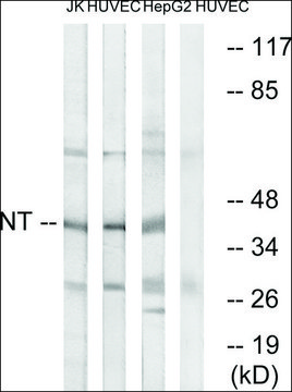 Anti-NT antibody produced in rabbit affinity isolated antibody