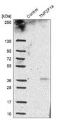 Anti-TNFSF14 antibody produced in rabbit Prestige Antibodies® Powered by Atlas Antibodies, affinity isolated antibody, buffered aqueous glycerol solution, Ab1