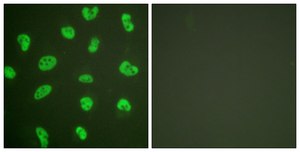 Anti-DNA-PK antibody produced in rabbit affinity isolated antibody