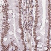Anti-SREK1 antibody produced in rabbit Prestige Antibodies® Powered by Atlas Antibodies, affinity isolated antibody