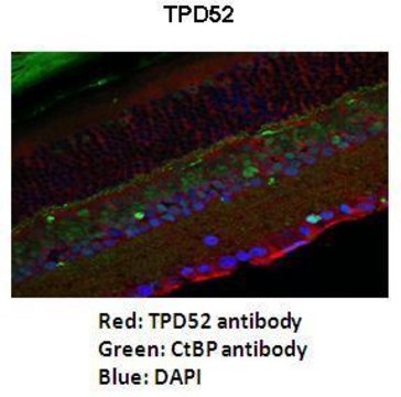 Anti-TPD52 antibody produced in rabbit affinity isolated antibody