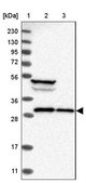 Anti-SBDS antibody produced in rabbit Prestige Antibodies® Powered by Atlas Antibodies, affinity isolated antibody, buffered aqueous glycerol solution