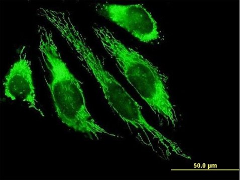 Anti-PDHB antibody produced in mouse purified immunoglobulin, buffered aqueous solution