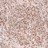 Monoclonal Anti-Msh3 Antibody Produced In Mouse Prestige Antibodies® Powered by Atlas Antibodies, clone CL14064, affinity isolated antibody, buffered aqueous glycerol solution