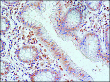 Anti-FUS (internal) antibody produced in rabbit ~1.0 mg/mL, affinity isolated antibody