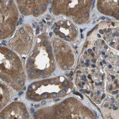 Anti-ARFGAP2 antibody produced in rabbit Prestige Antibodies® Powered by Atlas Antibodies, affinity isolated antibody, buffered aqueous glycerol solution