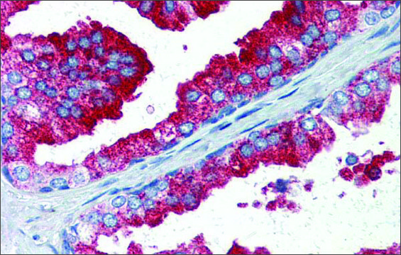 Anti-YAP1 antibody produced in rabbit affinity isolated antibody