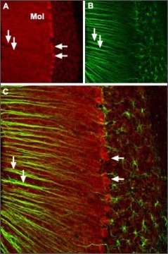 Anti-Calcium Channel (&#945;1A Subunit) (P/Q-type of Voltage-gated Ca2+ Channel) antibody produced in rabbit affinity isolated antibody, lyophilized powder