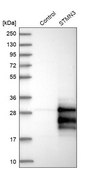 Anti-STMN3 antibody produced in rabbit Prestige Antibodies® Powered by Atlas Antibodies, affinity isolated antibody, buffered aqueous glycerol solution