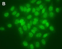 Anti-β-Galactosidase Antibody, clone 1G21 ZooMAb® Rabbit Monoclonal recombinant, expressed in HEK 293 cells