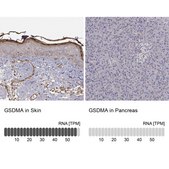 Anti-GSDMA antibody produced in rabbit Prestige Antibodies® Powered by Atlas Antibodies, affinity isolated antibody, buffered aqueous glycerol solution