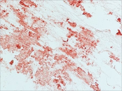 Anti-PRL-3 antibody produced in rabbit IgG fraction of antiserum, buffered aqueous solution