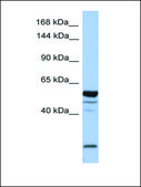 Anti-EPB41L2 antibody produced in rabbit affinity isolated antibody