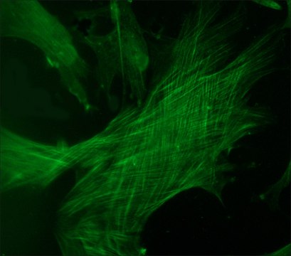 Anti-Tropomyosin antibody produced in rabbit whole antiserum