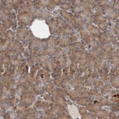 Anti-BCAP29 antibody produced in rabbit Prestige Antibodies® Powered by Atlas Antibodies, affinity isolated antibody, buffered aqueous glycerol solution