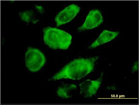 Monoclonal Anti-SSR4 antibody produced in mouse clone 2D3, purified immunoglobulin, buffered aqueous solution