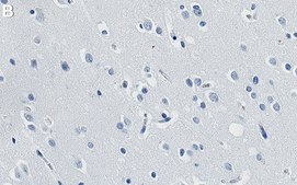 Anti-NOVA2 Antibody, clone 2J16 ZooMAb® Rabbit Monoclonal recombinant, expressed in HEK 293 cells