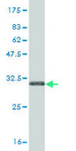 Monoclonal Anti-SLC5A2 antibody produced in mouse clone 3G8, purified immunoglobulin, buffered aqueous solution