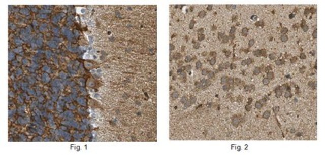 Anti-Tryptophan hydroxylase 1/TPH1 Antibody from rabbit, purified by affinity chromatography