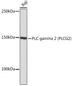 Anti-PLC gamma 2 (PLCG2) Antibody, clone 7I1C9, Rabbit Monoclonal