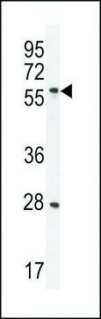 ANTI-DLK antibody produced in rabbit affinity isolated antibody, buffered aqueous solution