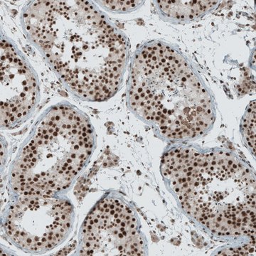 Anti-SENP1 antibody produced in rabbit Prestige Antibodies&#174; Powered by Atlas Antibodies, affinity isolated antibody, buffered aqueous glycerol solution