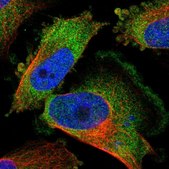 Anti-KCTD3 antibody produced in rabbit Prestige Antibodies® Powered by Atlas Antibodies, affinity isolated antibody, buffered aqueous glycerol solution