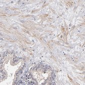 Anti-DMD antibody produced in rabbit Prestige Antibodies® Powered by Atlas Antibodies, affinity isolated antibody, buffered aqueous glycerol solution
