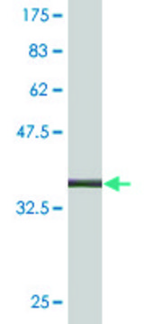 Monoclonal Anti-LCN1 antibody produced in mouse clone 1B11, purified immunoglobulin, buffered aqueous solution