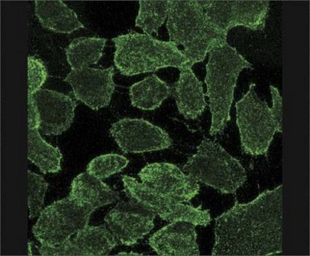 Anti-MDR1 Antibody, extracellular human specific Pgp, clone MM4.17 clone MM4.17, Chemicon&#174;, from mouse