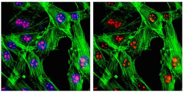 抗-SC-35抗体，克隆1SC-4F11 ascites fluid, clone 1SC-4F11, from mouse