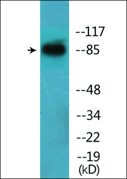 Anti-phospho-Catenin-&#946; (pTyr654) antibody produced in rabbit affinity isolated antibody