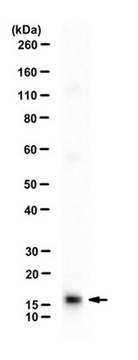 Anti-Ubiquitin-conjugating enzyme E2 A Antibody from rabbit, purified by affinity chromatography