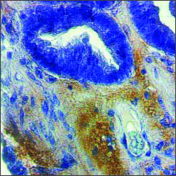 Anti-MMP2 IgG fraction of antiserum