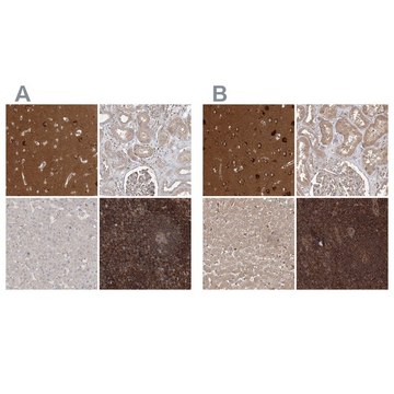 Anti-WDR37 antibody produced in rabbit Prestige Antibodies&#174; Powered by Atlas Antibodies, affinity isolated antibody, buffered aqueous glycerol solution