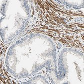 Anti-P4HA3 antibody produced in rabbit Prestige Antibodies® Powered by Atlas Antibodies, affinity isolated antibody, buffered aqueous glycerol solution