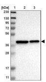 Anti-TMEM19 antibody produced in rabbit Prestige Antibodies® Powered by Atlas Antibodies, affinity isolated antibody, buffered aqueous glycerol solution