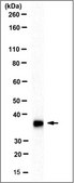 Anti-RLBP1 Antibody, clone 3C1.1 clone 3C1.1, from mouse