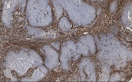 Anti-TAGLN Antibody, clone 1D10 , ZooMAb® Rabbit Monoclonal recombinant, expressed in HEK 293 cells