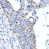 Anti-ATP5A1 antibody produced in rabbit