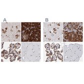 Anti-SND1 antibody produced in rabbit Prestige Antibodies® Powered by Atlas Antibodies, affinity isolated antibody, buffered aqueous glycerol solution