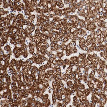 Anti-GIT1 antibody produced in rabbit Ab2, Prestige Antibodies&#174; Powered by Atlas Antibodies, affinity isolated antibody, buffered aqueous glycerol solution