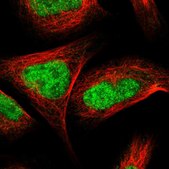 Anti-ZNF462 antibody produced in rabbit Prestige Antibodies® Powered by Atlas Antibodies, affinity isolated antibody, buffered aqueous glycerol solution