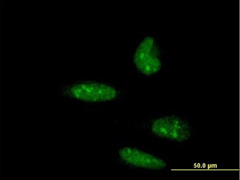 ANTI-ATOH1 antibody produced in mouse clone 2A12, purified immunoglobulin, buffered aqueous solution